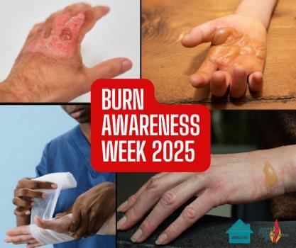 national burn awareness week