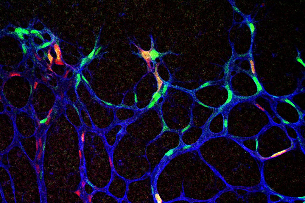 IB4-PF at angiogenic front 20x