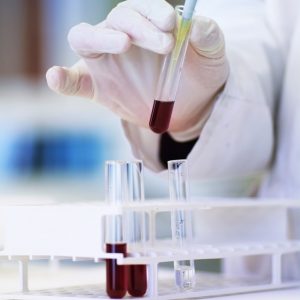 drug-test-300x300