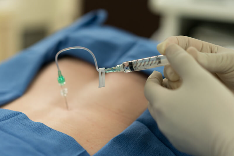 A pain management specialist administers an epidural.