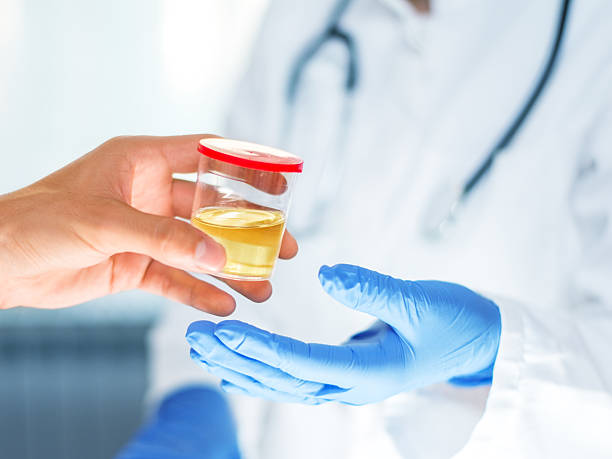 Man handing container with urine sample to a doctor Man handing container with urine sample to a doctor